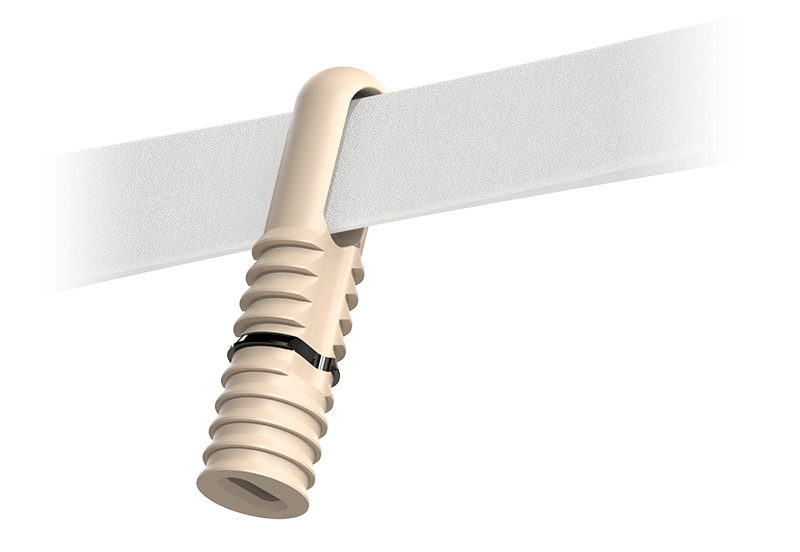 Close-up image of BioBrace scaffolding threaded through the Hercules XE eye